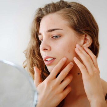 Pigmentation treatment in islamabad - best dermatoligst in islamabad dr. shumaila khan