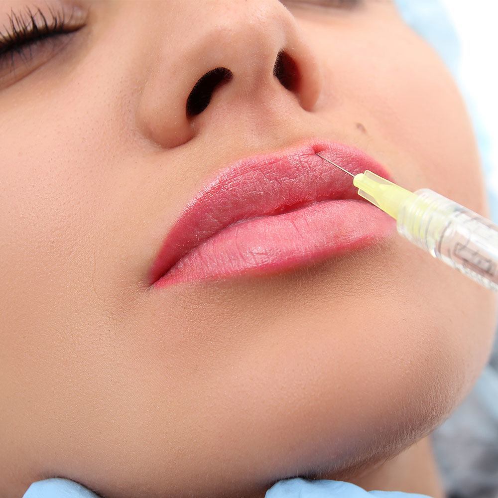 Lip Reduction Treatment3