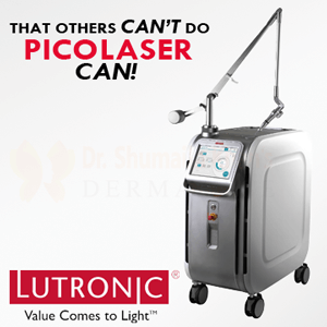 Pico Laser in islamabad