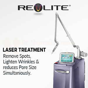 Revlite Laser islamabad