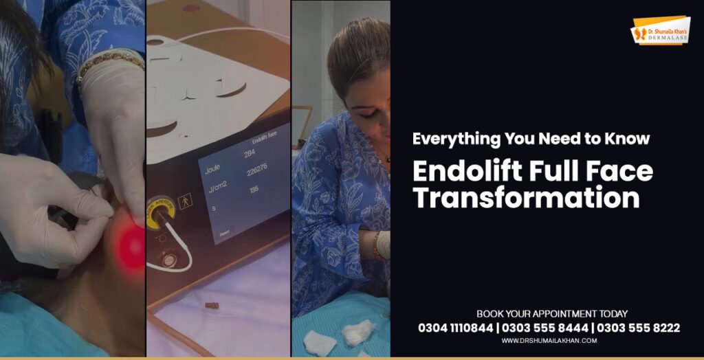 Endolift-Full-Face-Transformation-Cover-Post-by-Dermatologist-Dr.-Shumaila-Khan-in-Islamabad