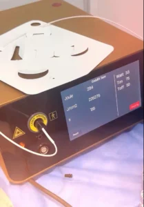 Eufoton Endolift Original Device Dermalase Islamabad
