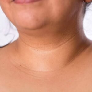 HOrizontial Neck Lines or tech neck lines